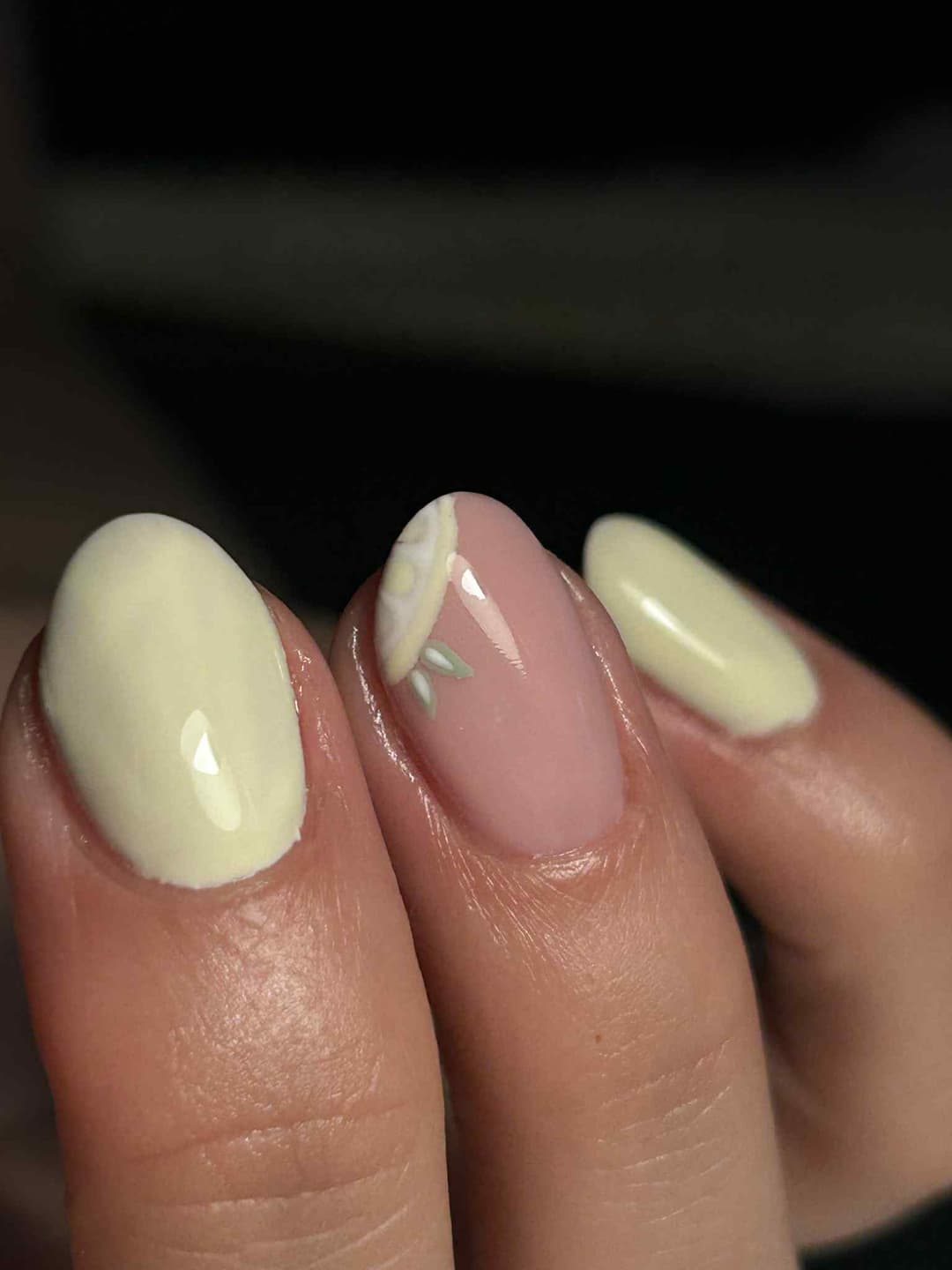 Epilatie behandeling in Kortrijk